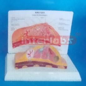 COMMON BREAST PATHOLOGIES MODEL WIDESCRIPTION PLATE